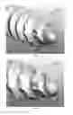 Fig. 09 - Spinal fastener with serrated thread