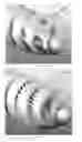 Fig. 10 - Spinal fastener with serrated thread