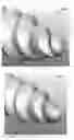 Fig. 11 - Spinal fastener with serrated thread