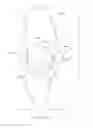 Fig. 15 - INTERSPINOUS STABILIZER