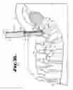 Fig. 15 - SPINAL FIXATION TOOL ATTACHMENT STRUCTURE