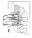 Fig. 19 - SPINAL FIXATION TOOL ATTACHMENT STRUCTURE