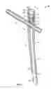 Fig. 03 - Implant system for bone fixation