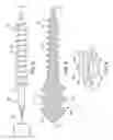 Fig. 03 - Orthopedic implant kit