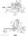 Fig. 04 - Instrumentation and technique for sizing a bone reconstruction graft