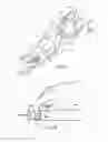 Fig. 22 - Catheter apparatuses, systems, and methods for renal neuromodulation