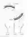 Fig. 31 - Catheter apparatuses, systems, and methods for renal neuromodulation