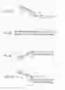 Fig. 33 - Catheter apparatuses, systems, and methods for renal neuromodulation