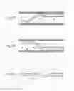 Fig. 34 - Catheter apparatuses, systems, and methods for renal neuromodulation