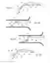 Fig. 35 - Catheter apparatuses, systems, and methods for renal neuromodulation