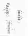 Fig. 38 - Catheter apparatuses, systems, and methods for renal neuromodulation