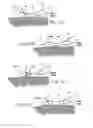 Fig. 57 - Catheter apparatuses, systems, and methods for renal neuromodulation