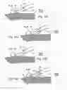 Fig. 59 - Catheter apparatuses, systems, and methods for renal neuromodulation