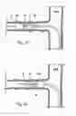 Fig. 64 - Catheter apparatuses, systems, and methods for renal neuromodulation