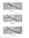 Fig. 73 - Catheter apparatuses, systems, and methods for renal neuromodulation