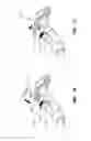 Fig. 12 - Tumor ablation devices and related methods