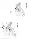 Fig. 17 - Tumor ablation devices and related methods
