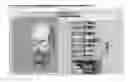 Fig. 01 - Image correction design system and method for oral and maxillofacial surgery