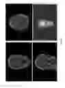 Fig. 14 - Image correction design system and method for oral and maxillofacial surgery