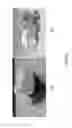 Fig. 15 - Image correction design system and method for oral and maxillofacial surgery