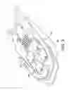 Fig. 03 - Surgical robot driving mechanism