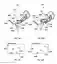 Fig. 15 - Surgical robotic automation with tracking markers and controlled tool advancement
