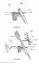 Fig. 16 - Surgical robotic automation with tracking markers and controlled tool advancement