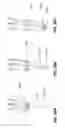 Fig. 32 - Surgical robotic automation with tracking markers and controlled tool advancement