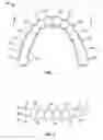 Fig. 02 - Dental appliance