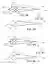 Fig. 04 - Embolic protection device