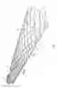 Fig. 02 - Stent