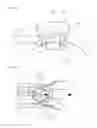 Fig. 07 - Intraocular lens assembly