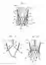 Fig. 02 - Sinus-engaging valve fixation member