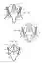 Fig. 03 - Sinus-engaging valve fixation member