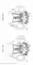 Fig. 12 - Sinus-engaging valve fixation member