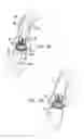 Fig. 14 - Sinus-engaging valve fixation member