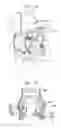 Fig. 21 - Sinus-engaging valve fixation member