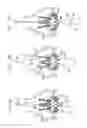 Fig. 24 - Sinus-engaging valve fixation member