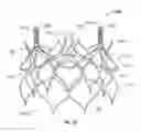 Fig. 26 - Sinus-engaging valve fixation member