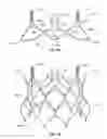 Fig. 27 - Sinus-engaging valve fixation member