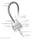 Fig. 01 - SYSTEM AND METHOD FOR REPLACING AN INFLAMED OR INFECTED HEART VALVE
