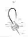 Fig. 02 - SYSTEM AND METHOD FOR REPLACING AN INFLAMED OR INFECTED HEART VALVE