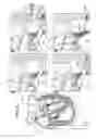 Fig. 02 - Prosthetic valve and upstream support therefor