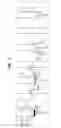 Fig. 08 - Prosthetic valve and upstream support therefor