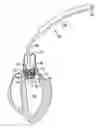 Fig. 01 - Methods of conformal expansion of prosthetic heart valves