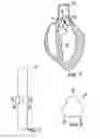 Fig. 02 - Methods of conformal expansion of prosthetic heart valves
