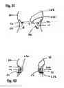 Fig. 06 - Two component mitral valve