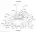 Fig. 01 - Expandable intervertebral spacer and method of posterior insertion thereof