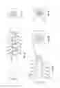 Fig. 02 - Expandable intervertebral spacer and method of posterior insertion thereof