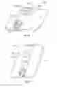 Fig. 06 - Transforaminal prosthetic spinal disc apparatus